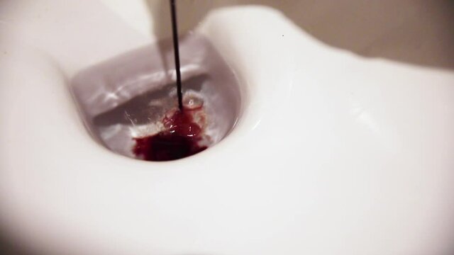 Blood flowing in the toilet, shadow of female hand emtyping menstrual cup in white toilet.