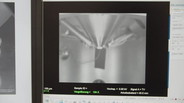 Microscopic Examination / Screen, Labor Work