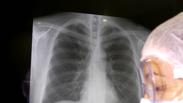 The doctor looks at the x-ray of the lungs. Pneumonia diagnosis. Consultation of doctors on covid 19. Patient examination