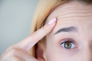 The woman has mimic wrinkles on her forehead