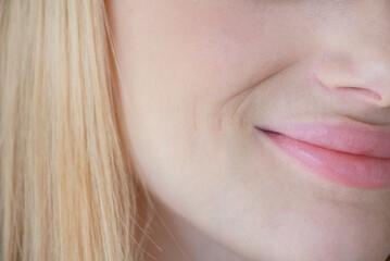 
A young girl has mimic wrinkles around her mouth