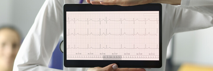 Doctor holding tablet with electrocardiogram in clinic closeup. Diagnosis of heart rhythm disorders...