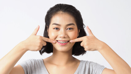Dental brace teen girl smiling looking on a camera. white teeth with blue braces. Dental care. Asian woman smile with orthodontic accessories. Cosmetic dentistry, orthodontics treatment. studio shot.