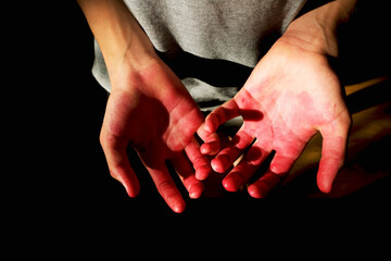 Bloody hands on a dark background.
