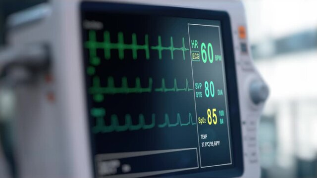 Heart rate monitor in hospital theater. Medical vital signs monitor instrument in a hospital on anesthesia surgery monitor. ECG. Patient heartbeat at the screen