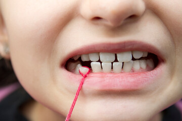 Tearing out a baby's tooth from a girl with a red string. Close-up, selective focus