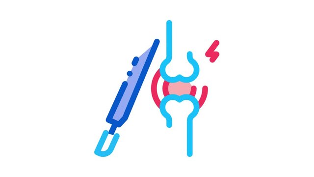 arthroscopy check Icon Animation. color arthroscopy check animated icon on white background