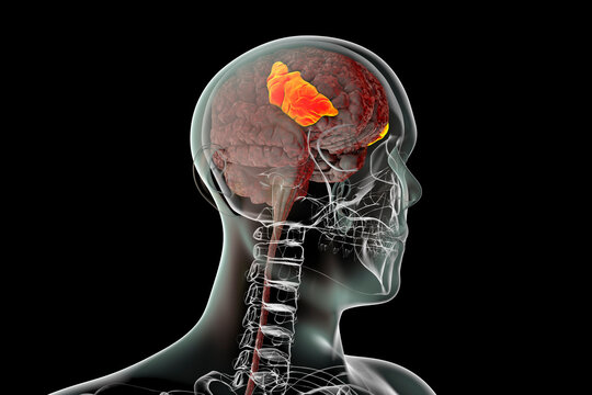 Human Brain In The Body With Highlighted Inferior Frontal Gyrus