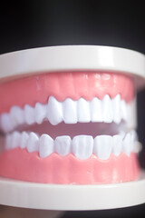 Dental white teeth model