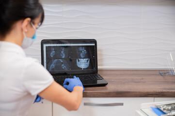 A back view of a young woman dentist working on laptop and looking at a patient's x-ray