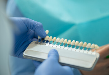 Closeup of dentist hand with blue latex gloves is holding a tooth veneer scale chart