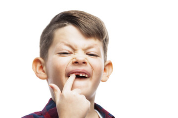 The boy who has lost his front tooth is smiling. Dental care. Close-up. Isolated on white background.