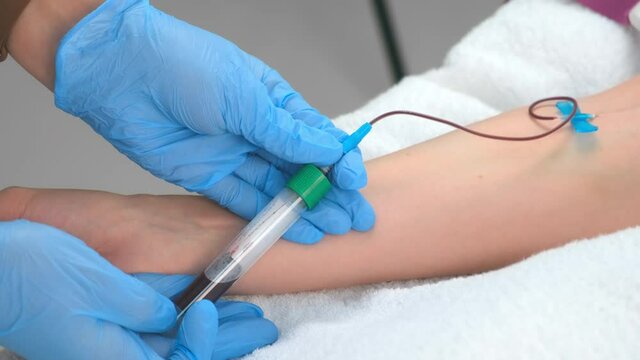 Laboratory worker doctor takes a blood sample for analysis, hand closeup. Blood sampling in the laboratory. Taking a blood in cosmetology clinic before PRP therapy procedure.