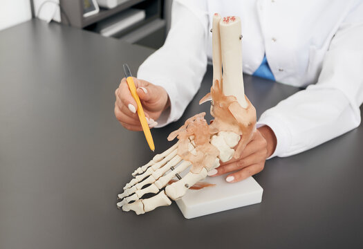 Doctor orthopedist shows to the anatomical model of the foot. Arthritis, foot injuries, flat feet and pain