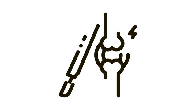 arthroscopy check Icon Animation. black arthroscopy check animated icon on white background