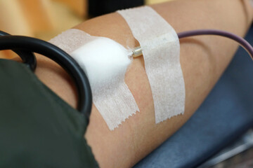 Color image depicting a blood donor in the process of donating blood in a medical clinic. Focus on the donor's arm.