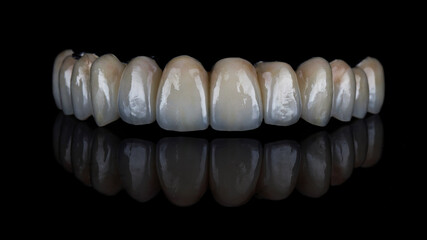 beautiful dental prosthesis of the upper jaw made of high-quality ceramic, filmed on a black background