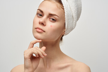 woman with towel on head naked shoulders clear skin acne spa treatments