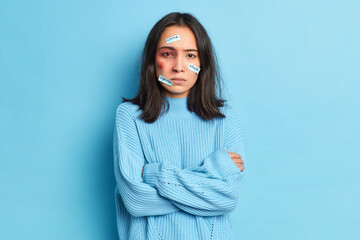 Traumatised bruised woman with bloody eye becomes vicitim of sexual assault or domestic violence...