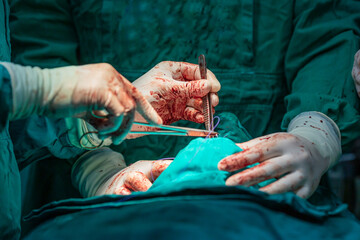 Surgical hands with blood during the surgery in hospital