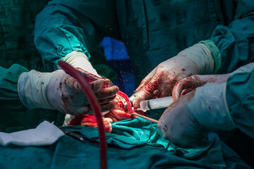 Surgical hands with blood during the surgery in hospital