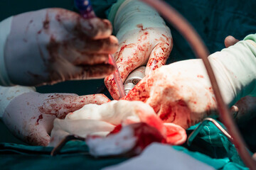 Surgical hands with blood during the surgery in hospital