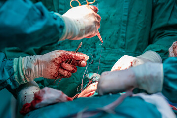 Surgical hands with blood during the surgery in hospital