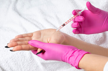 Obraz na płótnie Canvas The doctor cosmetologist makes injections of botulinum toxin on the palms of a woman against hyperhidrosis. Women's cosmetology, skin care.