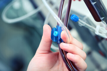 Hemodialysis tubes filled with filtering blood are held by the doctor's hand