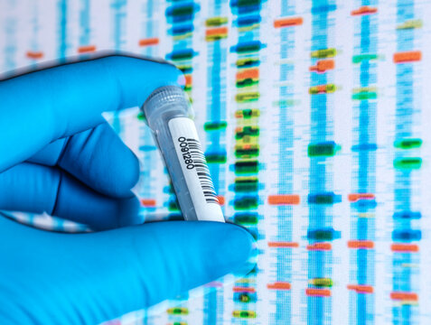 Scientists hand in latex glove holding vial containing sample with DNA results on screen in background