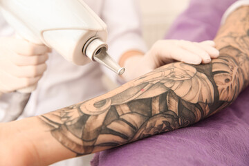 Young woman undergoing laser tattoo removal procedure in salon, closeup