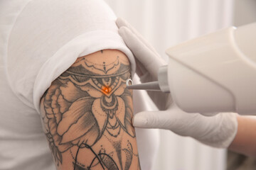 Young woman undergoing laser tattoo removal procedure in salon, closeup