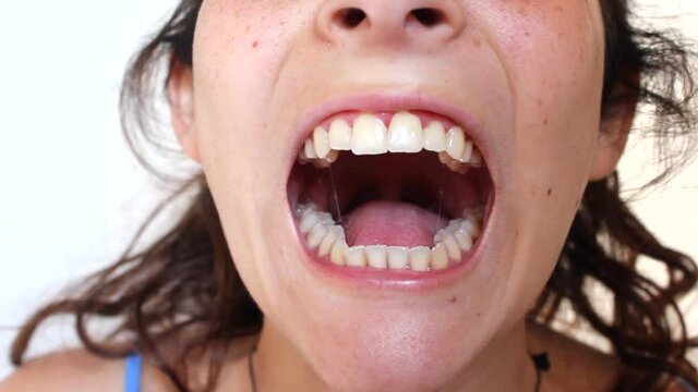 young woman showing her teeth. funny faces close up teeth. dental health care concept.