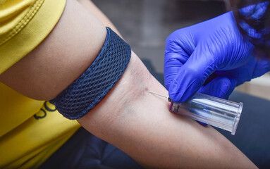 doctor taking blood sample with vacuum tube using venipuncture technique in arm pit with safety...