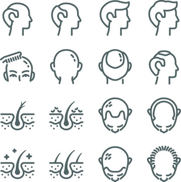 Hair loss icon illustration vector set. Contains such icons as Alopecia, bald, baldness, hair, hairless, loss, scalp, and more. Expanded Stroke