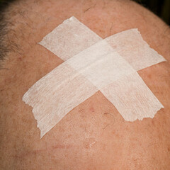 A medical patch on man's head.