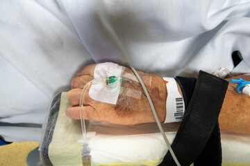in a hand of an operated patient is venous cannula for infusion