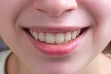 Smile and teeth of young woman by close up.Selective focus.Concept of dental care,good mood,positive.