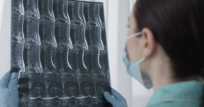 Female Doctor Examining MRI Film Scan of Lumbar Spines of a Patient with Chronic Back Pain