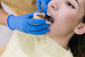 Young Female patient with open mouth examining dental inspection