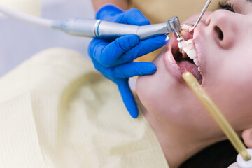 Young Female patient with open mouth examining dental inspection