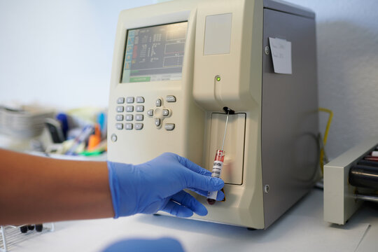Crop anonymous medical technologist in sterile gloves with blood tube near hematology analyzer while making diagnostic in lab