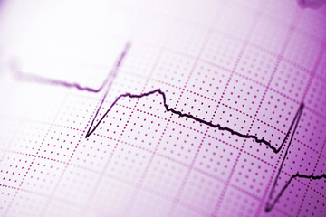 Electrocardiograph closeup view