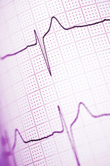 Electrocardiograph closeup view
