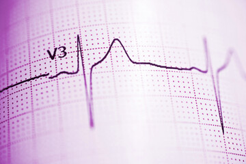 Electrocardiograph closeup view