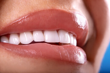 Perfect Close Up Sensual sexy Seductive Plump Lips woman smile . White beautiful Teeth bleaching...