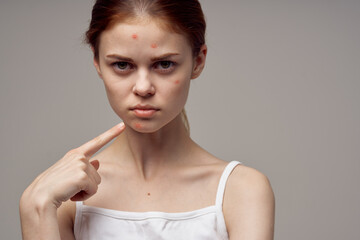 woman clean skin acne acne health problems dermatology