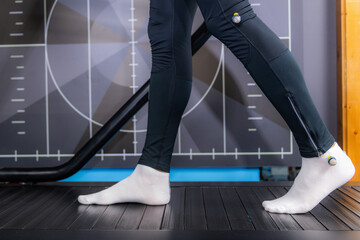 Walking Gait Analysis on Treadmill