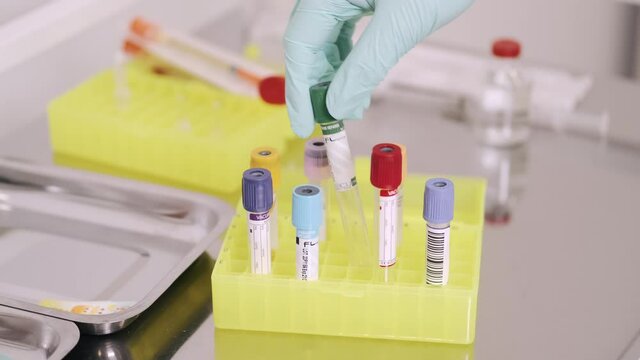 Blood testing, plr test, coronavirus concept. The doctor in the laboratory sorts test tubes with a sample of infected blood. Close-up view.