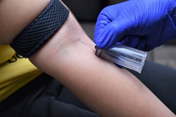 Blood collection using venipuncture technique in arm pit with safety gloves for covid19 test